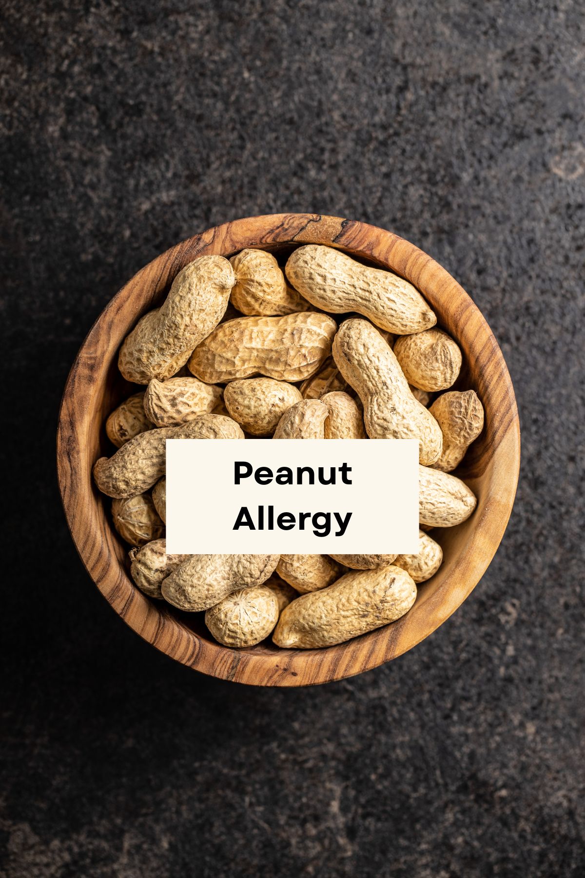 Peanut allergy 1.